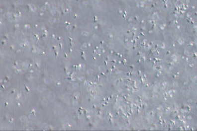 Moule (Mytilus edulis) -Spermatozoïdes x125
